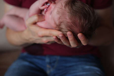How to Treat Baby Burns and Scalds Safely at Home